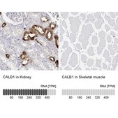 Anti-CALB1 antibody produced in rabbit Prestige Antibodies&#174; Powered by Atlas Antibodies, affinity isolated antibody, buffered aqueous glycerol solution
