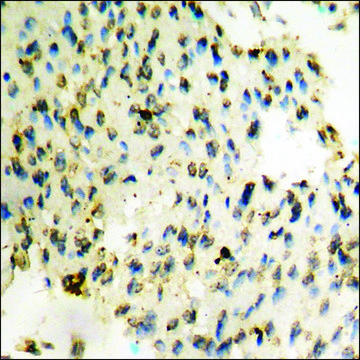 Anti-phospho-PYK2 (pTyr579) antibody produced in rabbit affinity isolated antibody