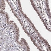 Anti-HMGA2 antibody produced in rabbit Prestige Antibodies&#174; Powered by Atlas Antibodies, affinity isolated antibody, buffered aqueous glycerol solution