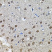 Anti-MYCN antibody produced in rabbit