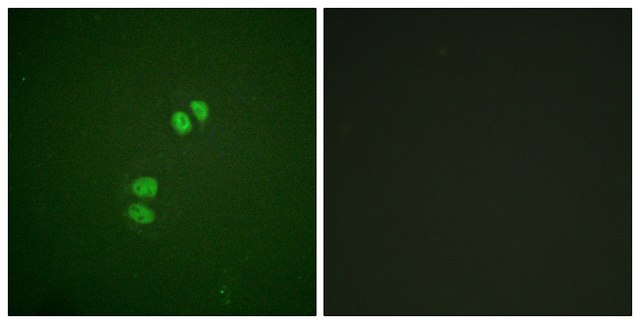 Anti-PLK1 antibody produced in rabbit affinity isolated antibody