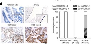 Anti-C/EBP-&#946; antibody produced in rabbit affinity isolated antibody