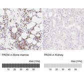Anti-PADI4 antibody produced in rabbit Prestige Antibodies&#174; Powered by Atlas Antibodies, affinity isolated antibody, buffered aqueous glycerol solution