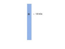 Anti-NMDAR1 Antibody, rabbit monoclonal culture supernatant, clone 1.17.2.6, Chemicon&#174;