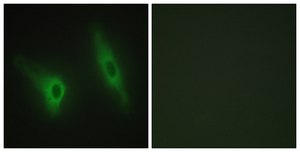 Anti-CKI-&#949; antibody produced in rabbit affinity isolated antibody