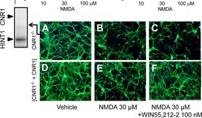 Anti-MAP2 (2a+2b) antibody, Mouse monoclonal clone AP-20, ascites fluid