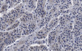 Anti-CXCR4 Antibody, clone 2L2, ZooMAb&#174; Rabbit Monoclonal recombinant, expressed in HEK 293 cells