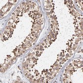 Anti-KTN1 antibody produced in rabbit Prestige Antibodies&#174; Powered by Atlas Antibodies, affinity isolated antibody, buffered aqueous glycerol solution