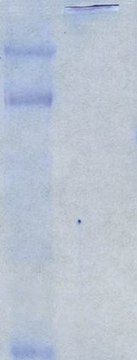 Chicken Extracellular Chondroitin Sulfate Proteoglycans