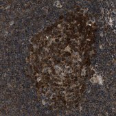 Anti-NUDCD3 antibody produced in rabbit Prestige Antibodies&#174; Powered by Atlas Antibodies, affinity isolated antibody, buffered aqueous glycerol solution, Ab1