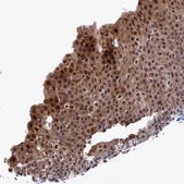 Anti-UBC antibody produced in rabbit Prestige Antibodies&#174; Powered by Atlas Antibodies, affinity isolated antibody, buffered aqueous glycerol solution