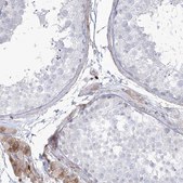 Anti-HYAL2 antibody produced in rabbit Prestige Antibodies&#174; Powered by Atlas Antibodies, affinity isolated antibody, buffered aqueous glycerol solution