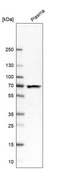 Anti-PTEN antibody produced in rabbit Prestige Antibodies&#174; Powered by Atlas Antibodies, affinity isolated antibody, buffered aqueous glycerol solution