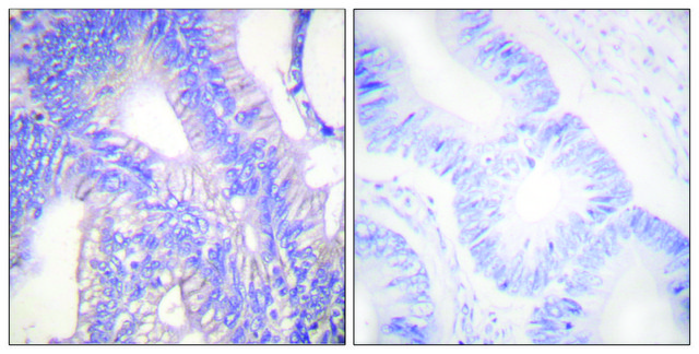 Anti-LYN antibody produced in rabbit affinity isolated antibody