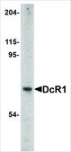 Anti-DCR1 (ab1) antibody produced in rabbit affinity isolated antibody, buffered aqueous solution