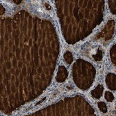 Anti-PDE1A antibody produced in rabbit Prestige Antibodies&#174; Powered by Atlas Antibodies, affinity isolated antibody, buffered aqueous glycerol solution