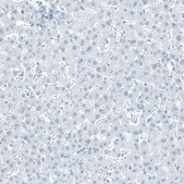 Anti-SLC22A8 antibody produced in rabbit Prestige Antibodies&#174; Powered by Atlas Antibodies, affinity isolated antibody, buffered aqueous glycerol solution