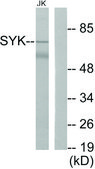 Anti-SYK antibody produced in rabbit affinity isolated antibody