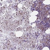 Anti-BPI antibody produced in rabbit Prestige Antibodies&#174; Powered by Atlas Antibodies, affinity isolated antibody, buffered aqueous glycerol solution