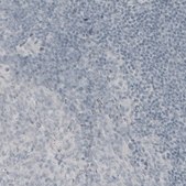 Monoclonal Anti-MBP antibody produced in mouse Prestige Antibodies&#174; Powered by Atlas Antibodies, clone CL2819, purified immunoglobulin, buffered aqueous glycerol solution