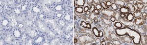 Anti-VDAC1 Antibody, clone 3M22, ZooMAb&#174; Rabbit Monoclonal recombinant, expressed in HEK 293 cells