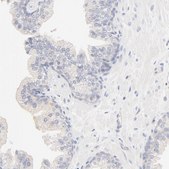 Anti-SPTB antibody produced in rabbit Ab1, Prestige Antibodies&#174; Powered by Atlas Antibodies, affinity isolated antibody, buffered aqueous glycerol solution