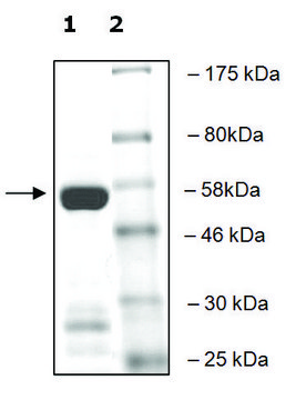 SETD2 active human recombinant, expressed in E. coli, &#8805;70% (SDS-PAGE)