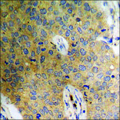 Anti-phospho-Catenin-&#946; (pSer37) antibody produced in rabbit affinity isolated antibody