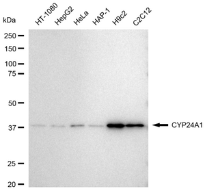 Anti CYP24A1 Antibody, clone 23GB3795, Rabbit Monoclonal clone 23GB3795, recombinant rabbit monoclonal, expressed in HEK293 cells