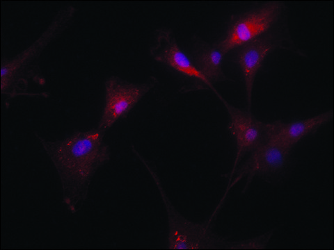 Anti-Transglutaminase-2 (C-terminal) antibody produced in rabbit ~1.5&#160;mg/mL, affinity isolated antibody