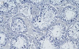 Anti-&#946; Tubulin Antibody, clone AA2 ZooMAb&#174; Mouse Monoclonal recombinant, expressed in HEK 293 cells