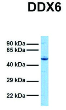 Anti-DDX6 (N-terminal) antibody produced in rabbit affinity isolated antibody