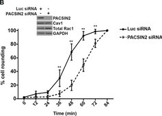 Anti-Rac1 Antibody, clone 23A8 clone 23A8, Upstate&#174;, from mouse