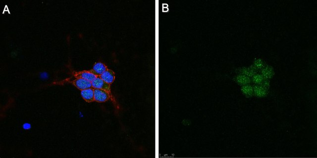 Anti-Pyk2/CAK&#946; Antibody