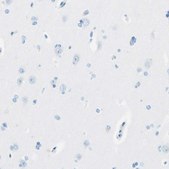 Anti-MFAP5 antibody produced in rabbit Prestige Antibodies&#174; Powered by Atlas Antibodies, affinity isolated antibody, buffered aqueous glycerol solution