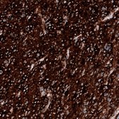 Monoclonal Anti-PTEN antibody produced in mouse Prestige Antibodies® Powered by Atlas Antibodies, clone CL11723, purified immunoglobulin, buffered aqueous glycerol solution