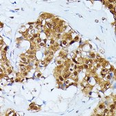 Anti-UBC antibody produced in rabbit