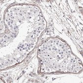 Anti-COL6A1 antibody produced in rabbit Prestige Antibodies&#174; Powered by Atlas Antibodies, affinity isolated antibody, buffered aqueous glycerol solution