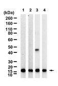 Anti-Interleukin-21 Antibody, clone 2B13 ZooMAb&#174; Rabbit Monoclonal recombinant, expressed in HEK 293 cells