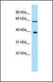 Anti-DDX3X, (N-terminal) antibody produced in rabbit affinity isolated antibody