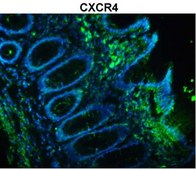 Anti-CXCR4 (N-terminal) antibody produced in rabbit affinity isolated antibody