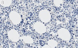 Anti-UTX Antibody, clone 4G9 ZooMAb&#174; Rabbit Monoclonal recombinant, expressed in HEK 293 cells