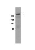 Anti-phospho-Acetyl CoA Carboxylase (Ser79) Antibody Upstate&#174;, from rabbit
