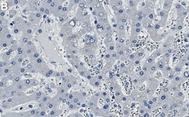 Anti-pro-Cathepsin D Antibody, clone 1D16 ZooMAb&#174; Rabbit Monoclonal recombinant, expressed in HEK 293 cells