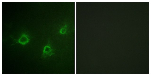 Anti-PLCG1 antibody produced in rabbit affinity isolated antibody