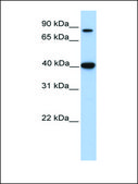 Anti-ACAT1 antibody produced in rabbit affinity isolated antibody