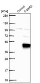 Anti-FOXR2 antibody produced in rabbit Prestige Antibodies&#174; Powered by Atlas Antibodies, affinity isolated antibody