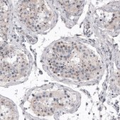 Monoclonal Anti-MKL1 antibody produced in mouse Prestige Antibodies&#174; Powered by Atlas Antibodies, clone CL4281, purified immunoglobulin