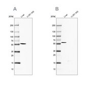 Anti-FTCD antibody produced in rabbit Prestige Antibodies&#174; Powered by Atlas Antibodies, affinity isolated antibody, buffered aqueous glycerol solution