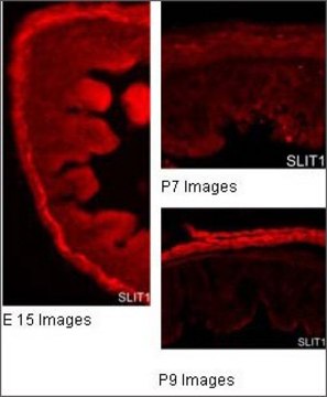Anti-SLIT1 antibody produced in rabbit affinity isolated antibody